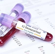 11-Deoxycortisol Test