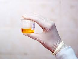 24 Hrs Urine Creatinine Clearance