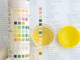 24 Hrs Urine Oxalate