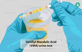 24 Hrs Urine VMA