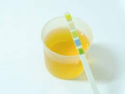 24Hrs Urine Calcium