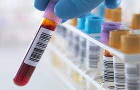 5 Alpha Reductase T2 Sequence