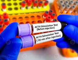 ACTH Stimulation (Synacthen)