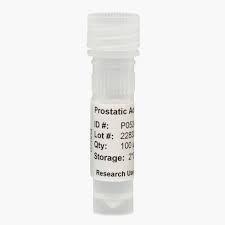 Acid Phosphatase (Prostatic fraction)