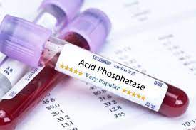 Acid Phosphatase (Total)