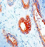 Acid phosphatase, total and prostatic fraction  -