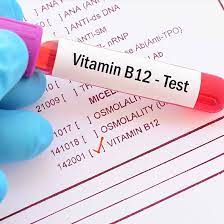 Active Vitamin B12 Holo-Transcobalamin (holoTC)