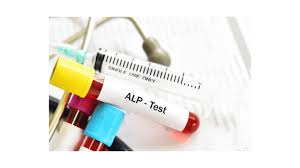 Alkaline Phosphatase ( Iso Enzyme)