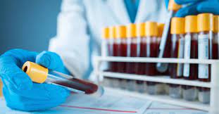 Alkaline Phosphatase Isoenzymes