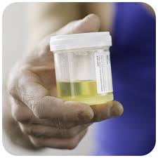 Amitriptyline in Urine