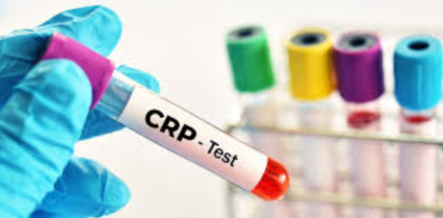 C-Reactive Protein (CRP)