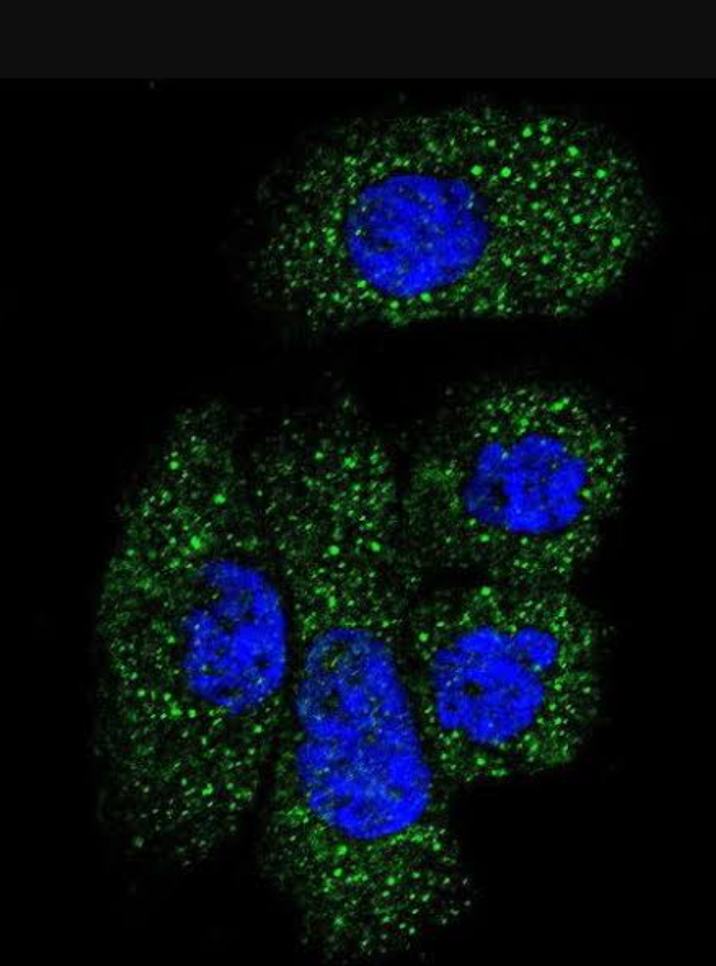 C1-Esterase-Inhibitor Antibodies