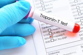 CARDIAC PROFILE (INC TROP T, CPK, CKMB)