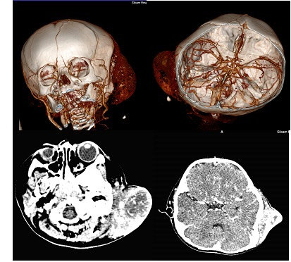 CT 3D Reconstruction