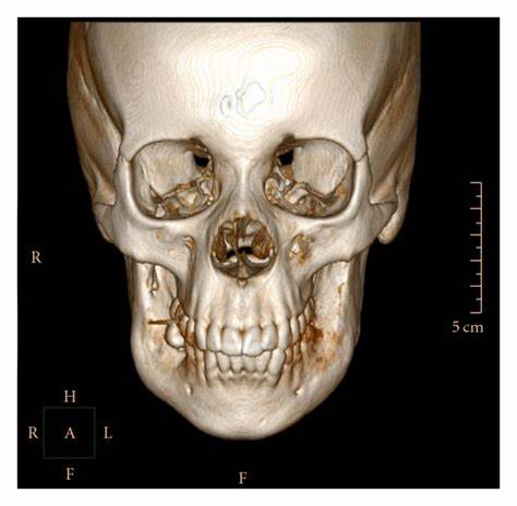 CT 3D Reconstruction