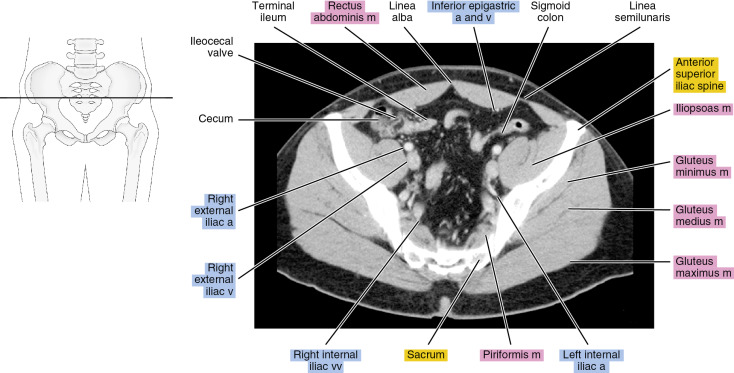 CT Abdomen and Pelvis Male