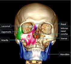 CT Maxillofacial