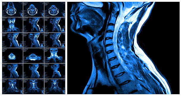 CT Neck