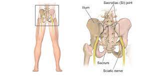 CT Sacro-iliac Joint