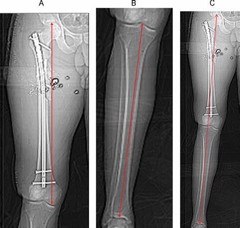 CT Scanogram