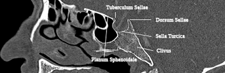 CT Sella