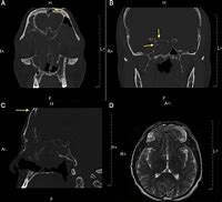 CT/MRI soft copy images