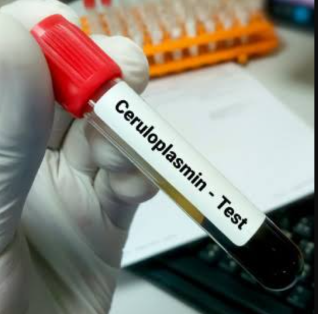 Caeruloplasmin (Ceruloplasmin)