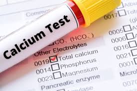 Calcium (Ionized)