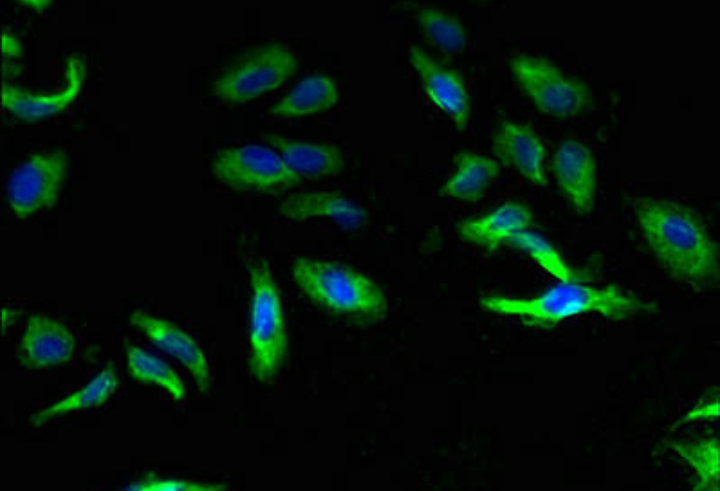 Calcium Sensing Receptor Abs