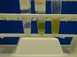 Cryoglobulines