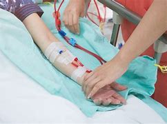 Dialysis Cannulation