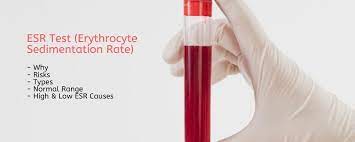 Erythrocyte Sedimentation Rate