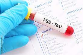 Fasting/Random Blood Sugar (FBS)