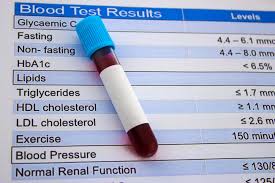 HDL Cholesterol