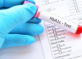 HbA1C