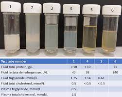 LDH (Pleural fluid)