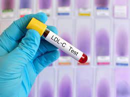 LDL - Cholesterol