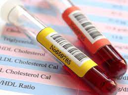 LDL / HDL Ratio