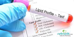 Lipid Profile