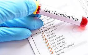 Liver Function Test