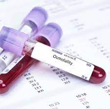 Osmolality Serum