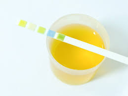 Osmolality Urine