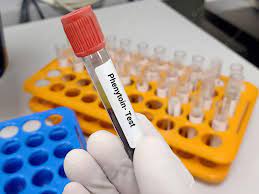 Phenytoin (Blood)