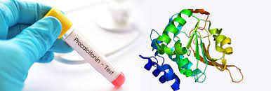 Procalitonin (Quantitative)