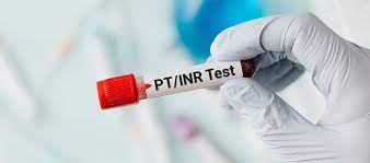 Prothrombin Time (PT) /INR