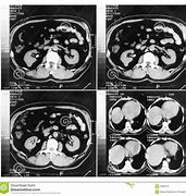 REPRINT OF CT/MRI FILM (PER FILM)