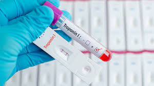 Troponin - I